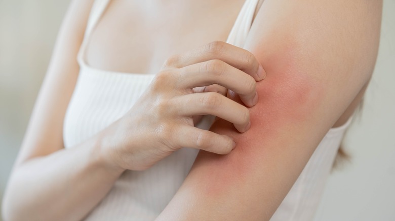 Redness on the skin