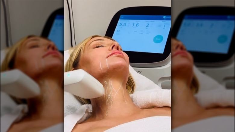 Brandi Glanville getting Sofwave treatment
