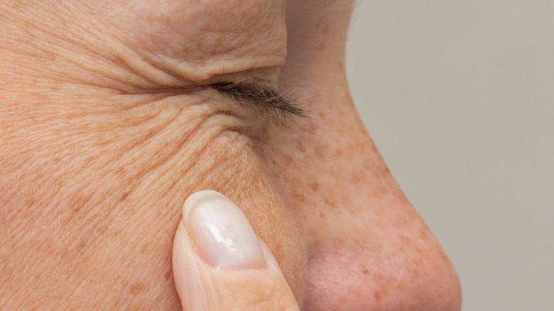 A close up of an eye with wrinkles and a finger touching freckled skin
