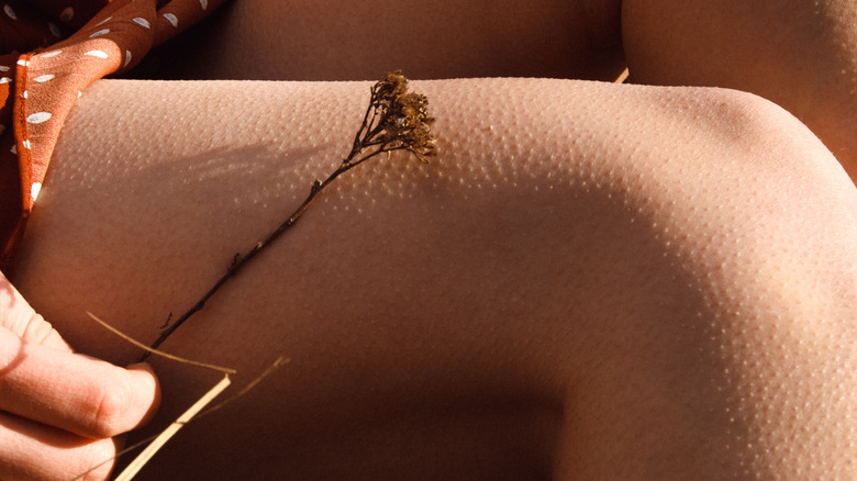 leg with goosebumps