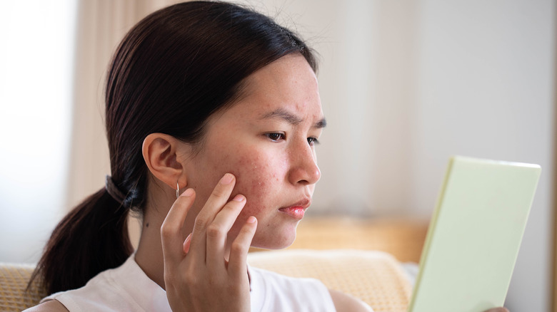 Woman looking at acne in mirror