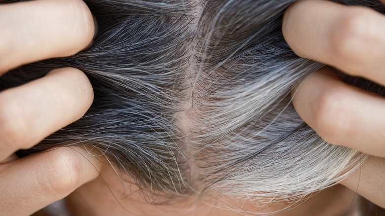 A top down view of hair roots with some gray strands