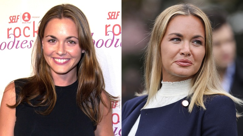 Side-by-side photos of Vanessa Trump comparing her look from when she was younger to her current look