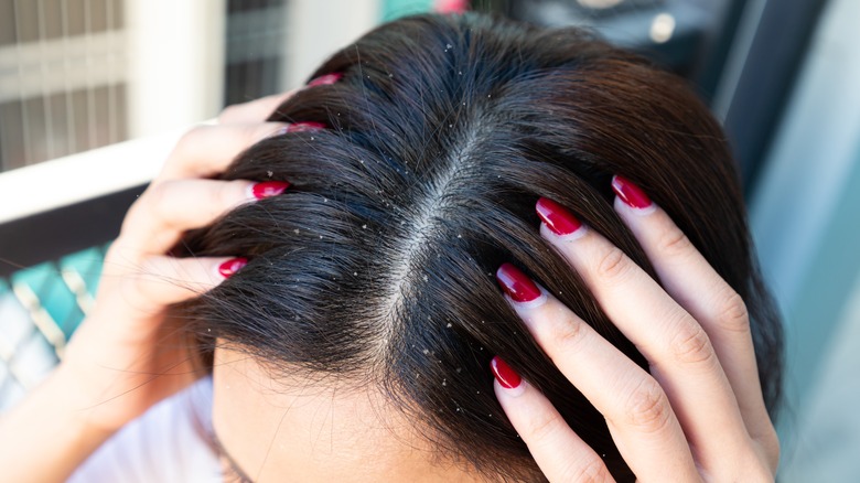 Chemical Hair Straightening Can Make Everyday Styling Easy But It Comes With Some Risks