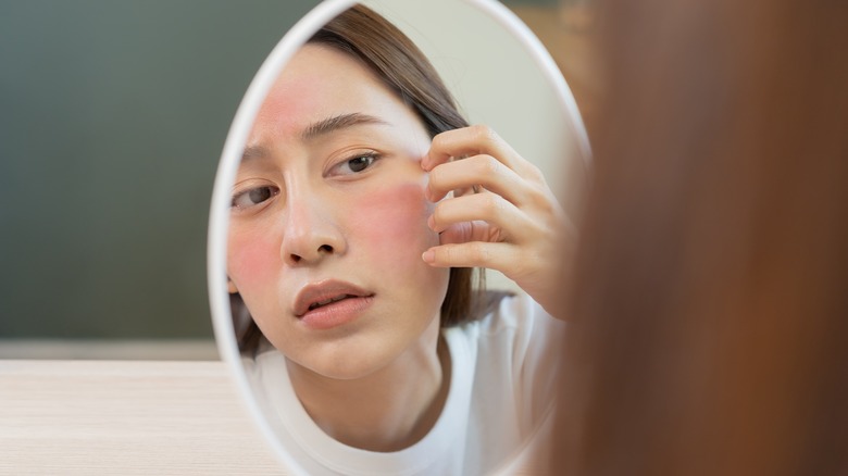 Irritated skin