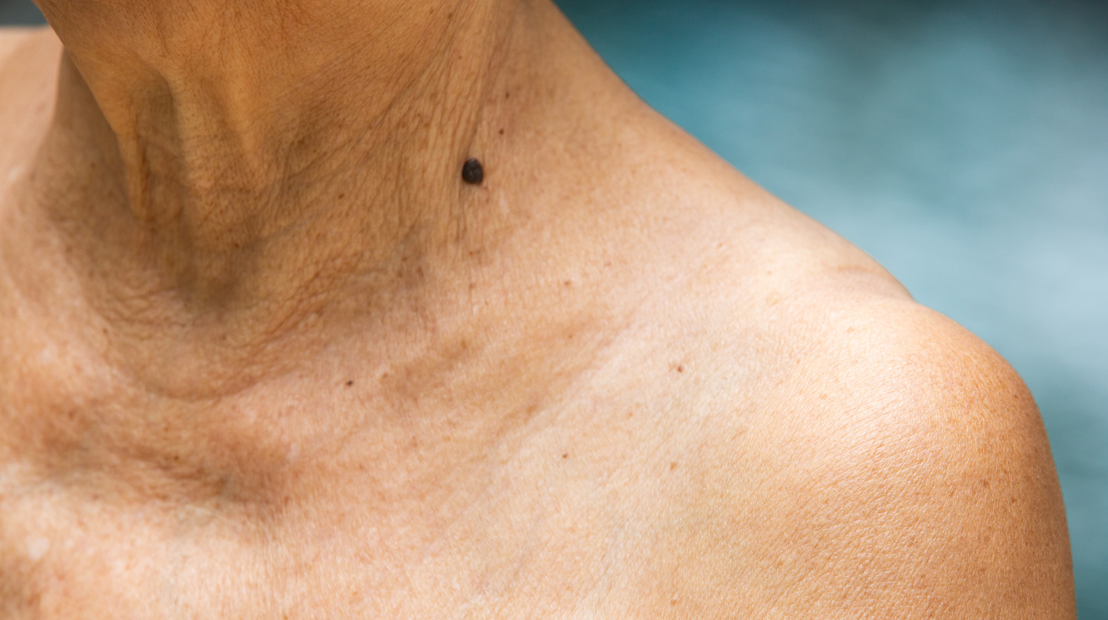 Crepey Skin The Causes & Prevention Tips To Know