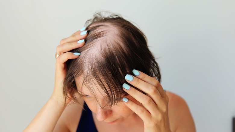 Woman with thinning hair