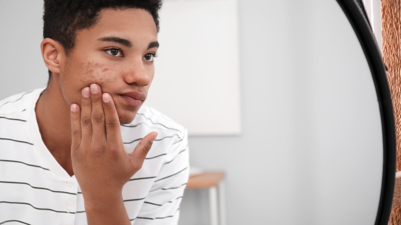Teen boy with acne