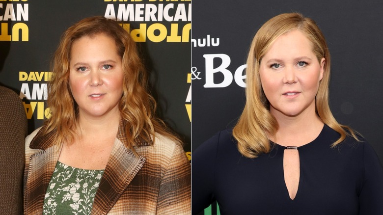 Side-by-side photos of Amy Schumer with a puffy face in October 2021 and a more defined face after removing her filler in March 2022