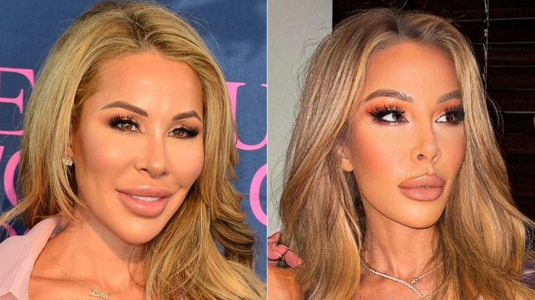 Side-by-side photos of Lisa Hochstein on the red carpet in 2020 and posing in 2023 with less facial filler