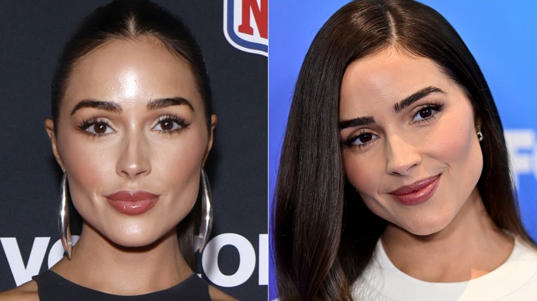 Side-by-side photos of Olivia Culpo in February 2024 and May 2024 after dissolving her lip fillers