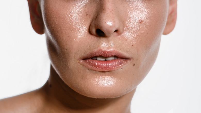 Oily skin