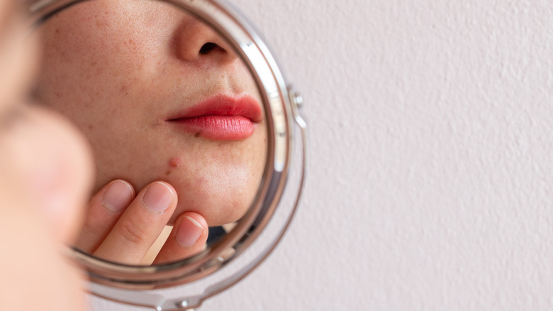 Woman looking at acne in the mirror