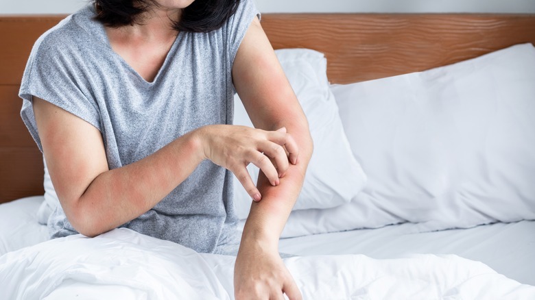 Woman scratching skin
