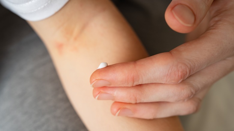 person applying cream inside elbow