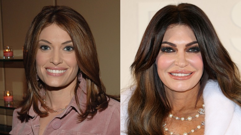 Side-by-side photos of Kimberly Guilfoyle then vs. now