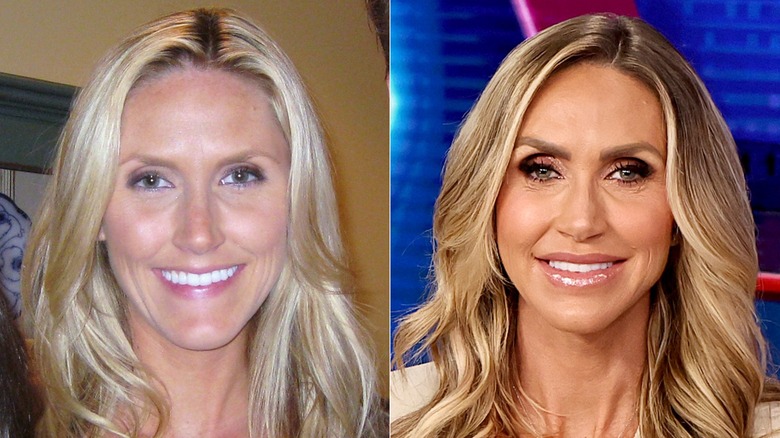 Side-by-side photos of Lara Trump then vs. now