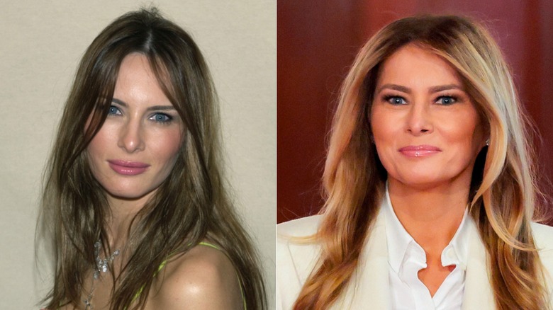 Side-by-side pictures of Melania Trump comparing her younger face to her current face