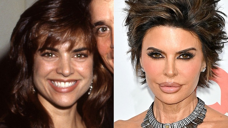 Lisa Rinna smiling in 1989 and pouting on the red carpet in 2026, side by side photos