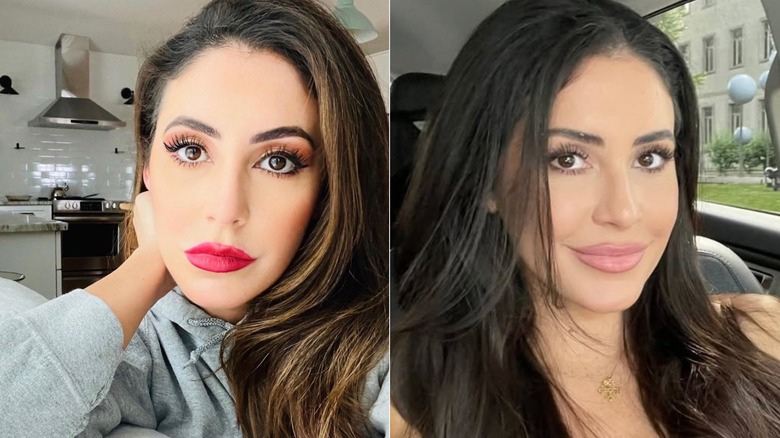 Anna Paulina Luna overlined lips vs fillers