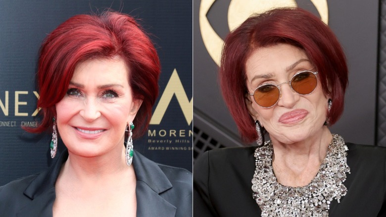 Side-by-side photos of Sharon Osbourne before and after her weight loss