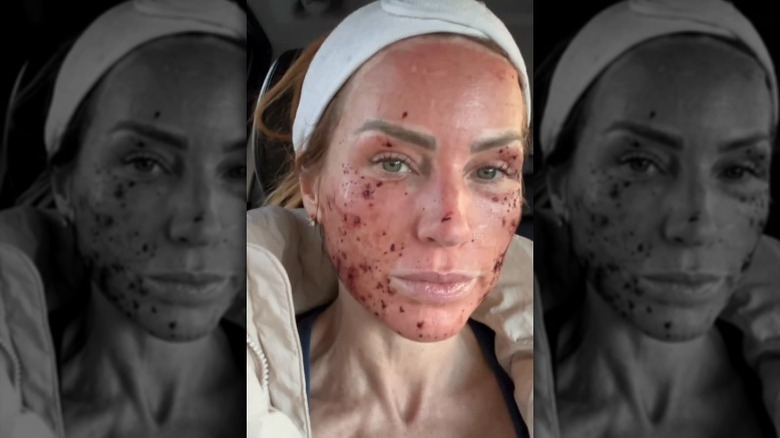 Mina Starsiak Hawk poses for the camera after her laser treatment