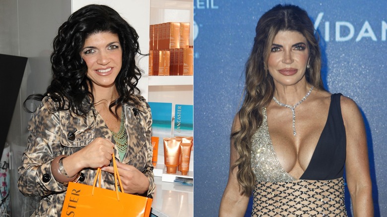 Teresa Guidice in 2009 and 2025, side by side photos