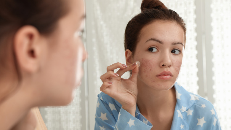 Woman applying pimple patch