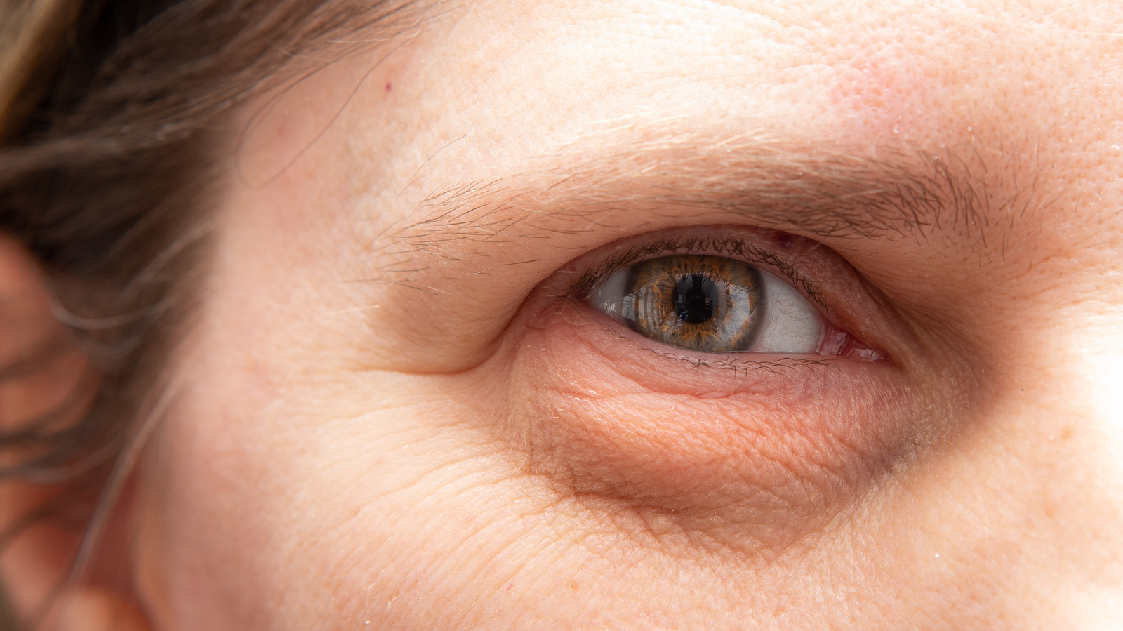 Struggling With Puffy Eyes? The Most Common Causes, Explained