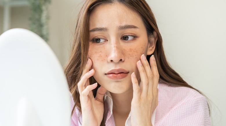 woman looking at melasma in mirror