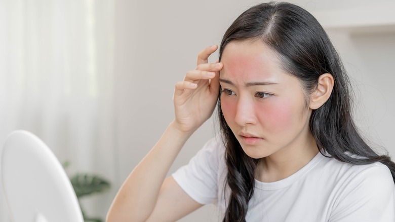Skin redness