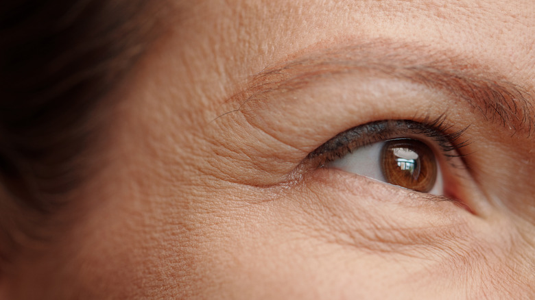 crows feet up close