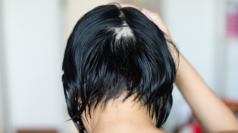 Woman with bald spot