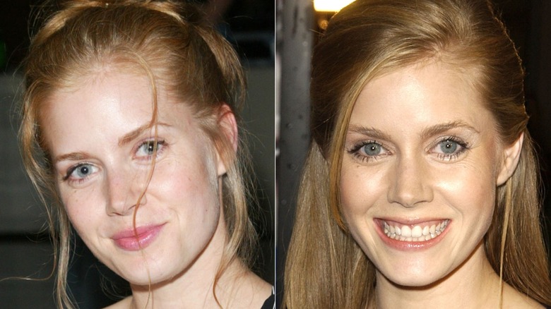 Amy Adams smiling in two photos taken in 2002