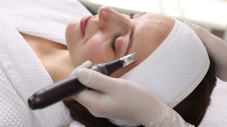 A young woman undergoes a microneedling procedure