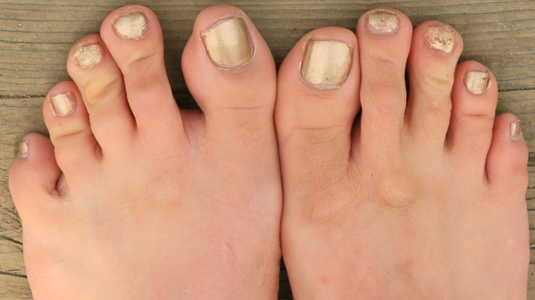 Gold pedicure