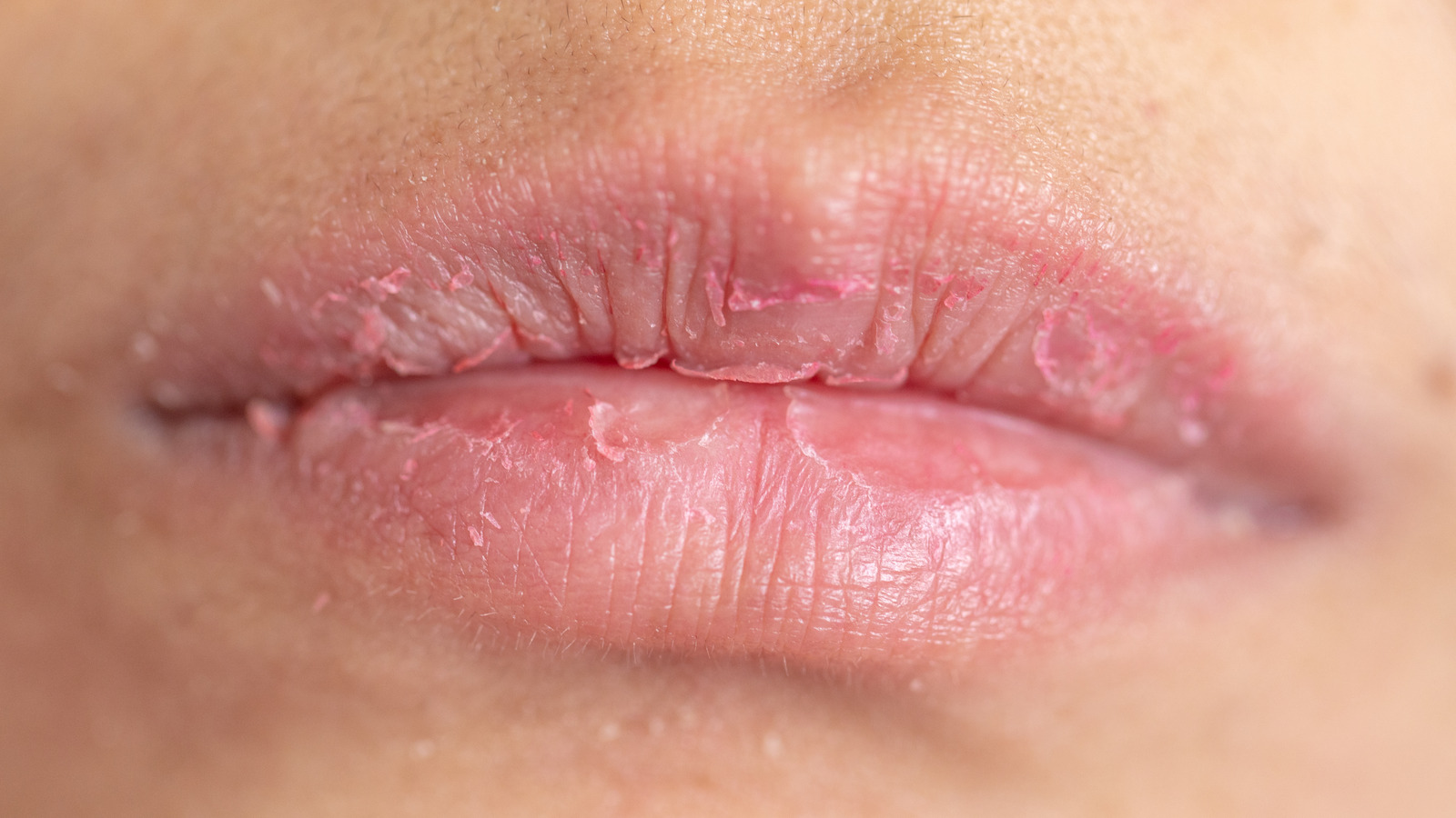 The Products & Ingredients To Avoid If You Have Chapped Lips