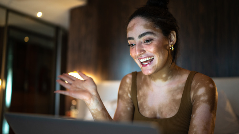 Women with vitiligo