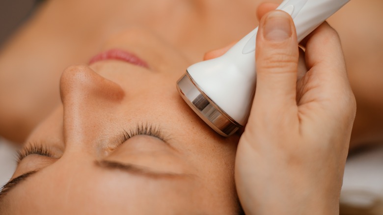 Getting laser peel