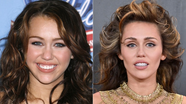 Side-by-side photos of Miley Cyrus before and after getting veneers