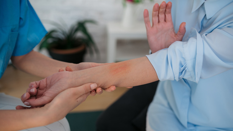 doctor diagnosing skin inflammation