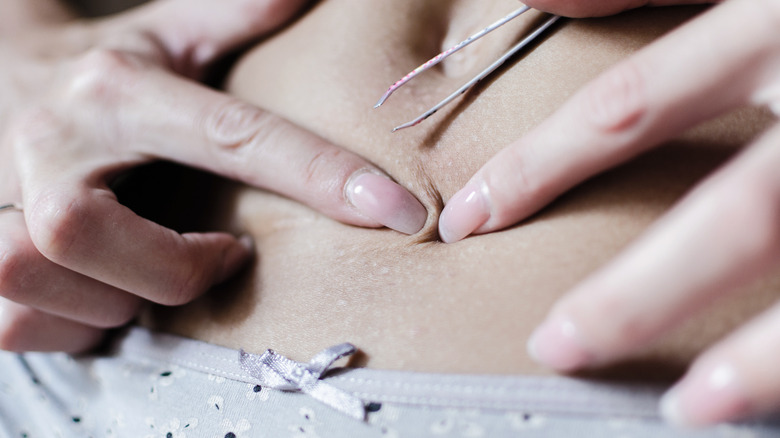 Ingrown hairs