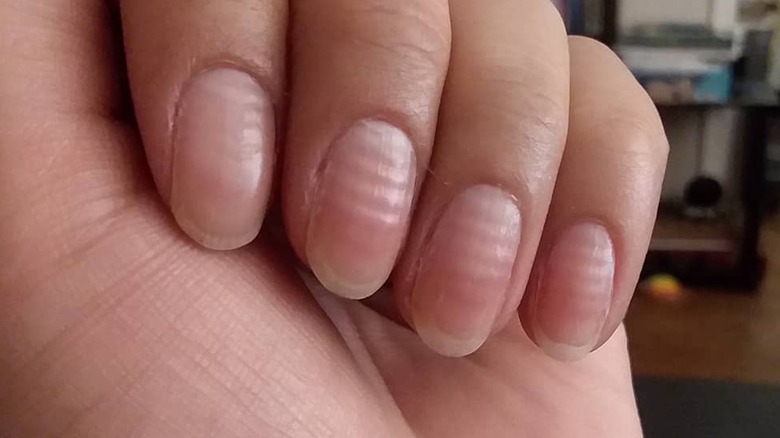 Ridged nails