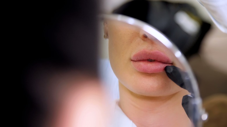 woman with filler in lips