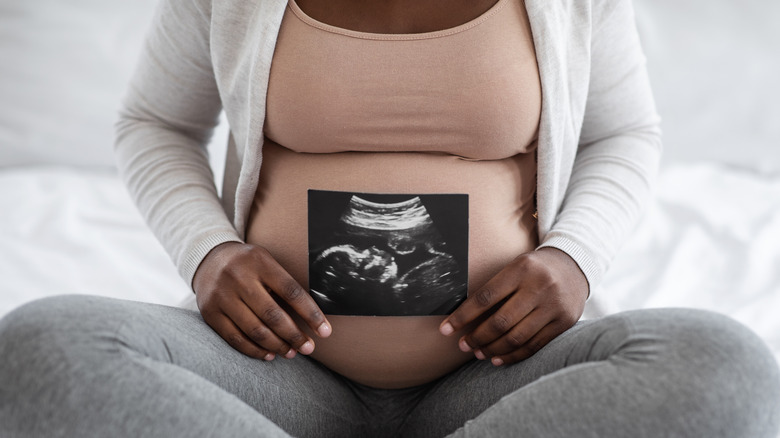 Pregnant woman sits lotus holding sonogram