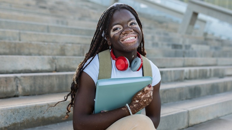 A person with vitiligo