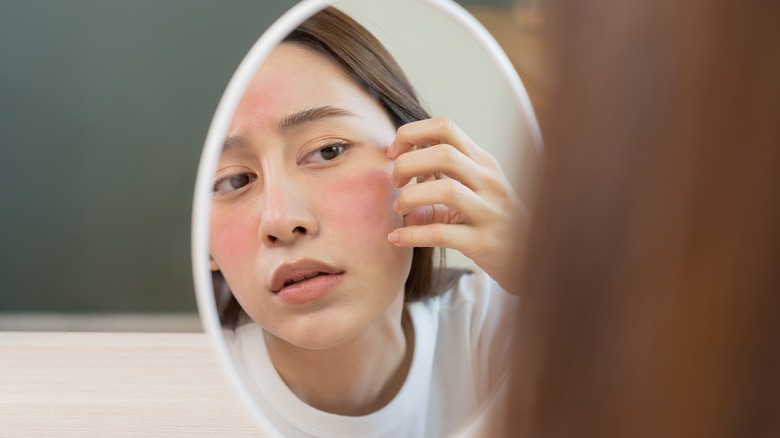 Skin irritation