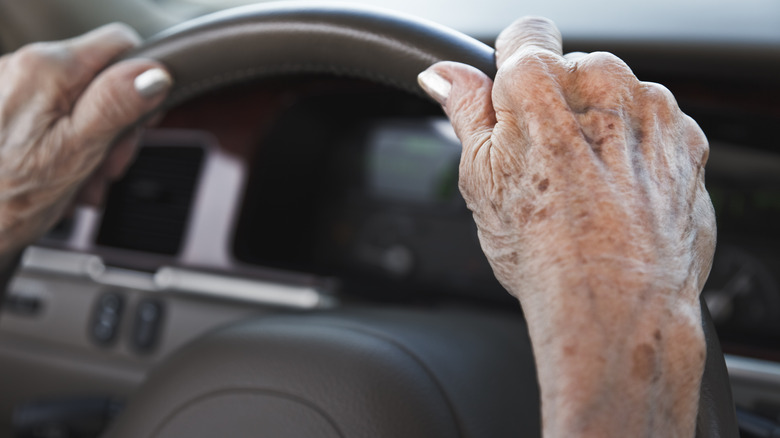 Age spots on hands