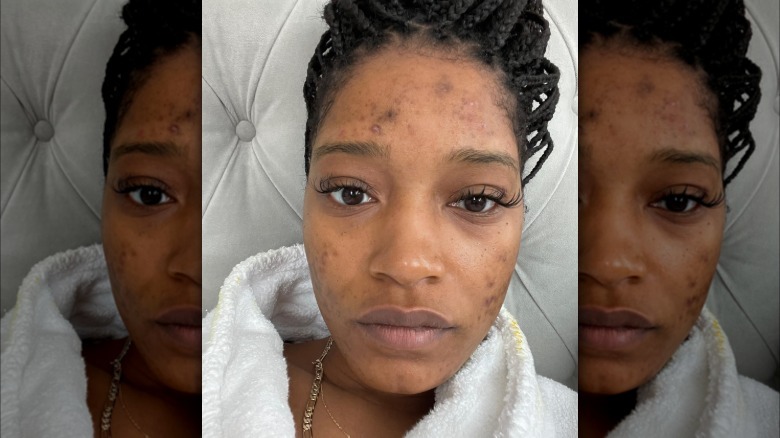 Keke Palmer shares a selfie on her Instagram of herself as makeup-free