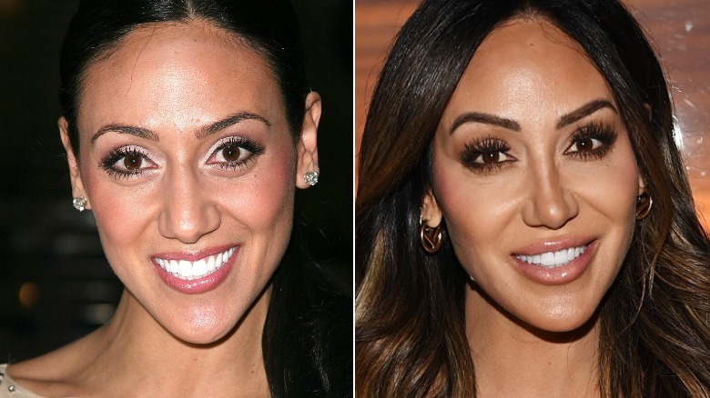 Side-by-side pics of Melissa Gorga